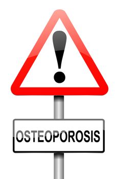 Illustration depicting a sign with an osteoporosis concept.