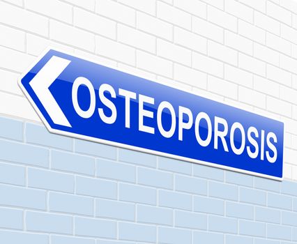 Illustration depicting a sign with an osteoporosis concept.