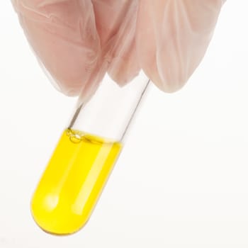 Fingers holding test tube with yellow liquid.