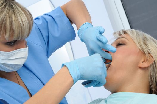 Dentist at work, tooth extraction using forceps