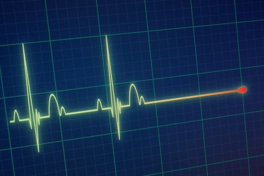 Flatline blip on a medical heart monitor ECG / EKG (electrocardiogram) with blue background