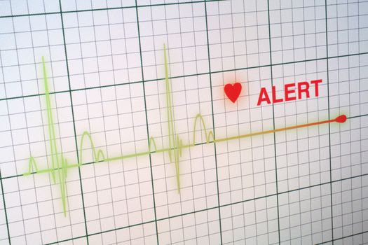Flat line alert on a heart monitor.