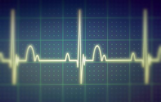 Flatline blip on a medical heart monitor ECG / EKG (electrocardiogram) with blue background