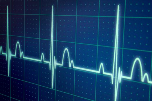 Flatline blip on a medical heart monitor ECG / EKG (electrocardiogram) with blue background