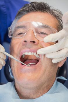Patient mouth open and dentist examining with angled mirror in dental clinic