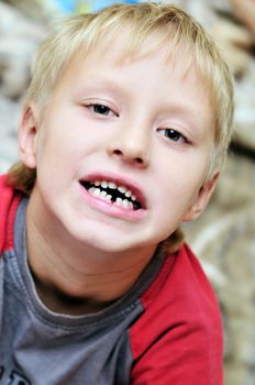 little boy showing that he lost first  milk tooth  