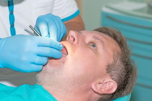 man in dentist office having annual check up