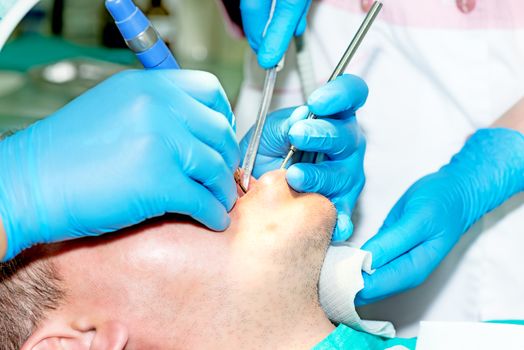 Patient in dentist office having teeth fixed up