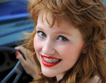 Female fashion model expressions with colorful teeth braces.