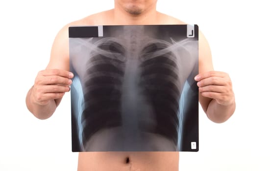 unidentify person showing x-ray film isolated on white background