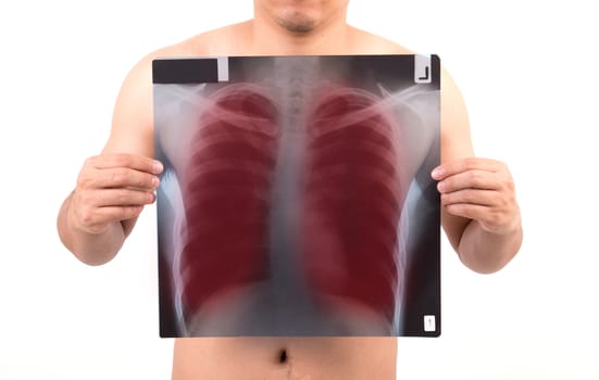 unidentify person showing x-ray film with red label isolated on white background