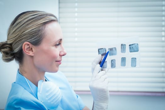 Side view of concentrated female dentist looking at x-ray
