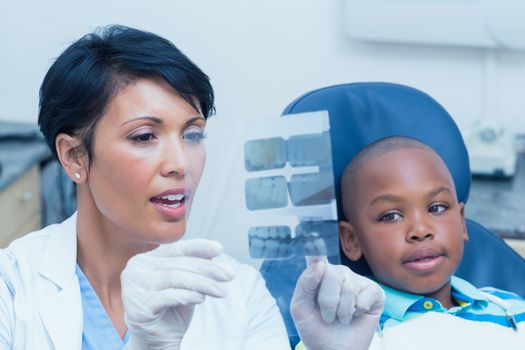 Female dentist showing young boy his mouth x-ray in the dentists chair