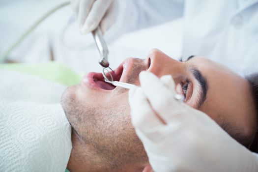 Close up of man having his teeth examined by dentist