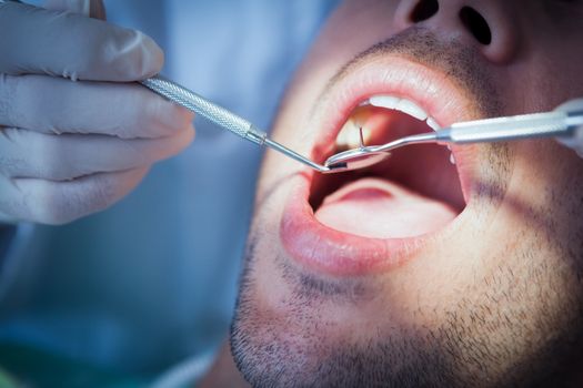 Close up of man having his teeth examined by dentist