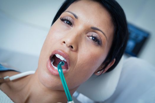 Close up of woman having her teeth examined by dentist