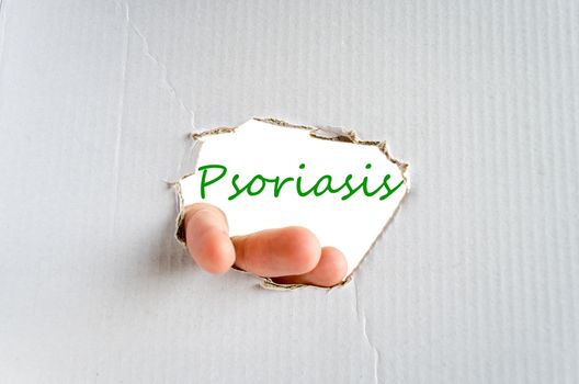 Hand on the cardboard background psoriasis concept