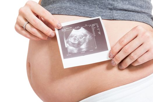 Pregnant woman displaying a prenatal ultrasound scan showing her unborn foetus in the womb against her swollen belly, isolated on white