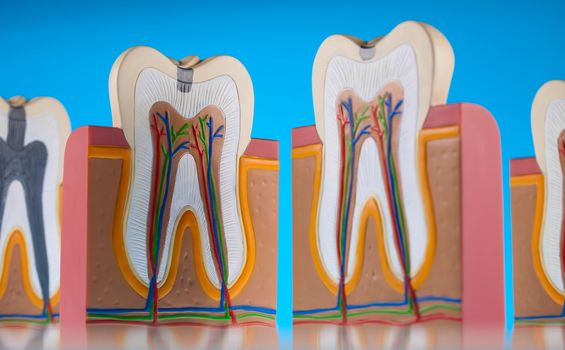 Tooth, bright colorful tone concept