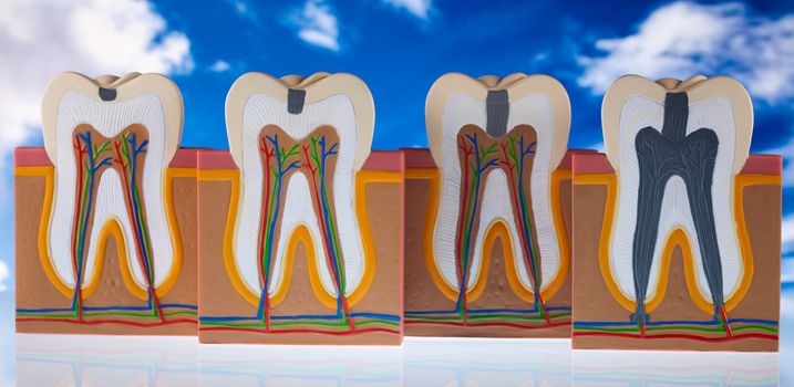 Teeth, bright colorful tone concept