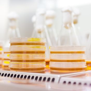 Close up of cell culture samples on LB agar medium in petri dish in laminar flow. Agar plates are used by biologists to culture cells, mold, fungi, bacteria or small moss plants.