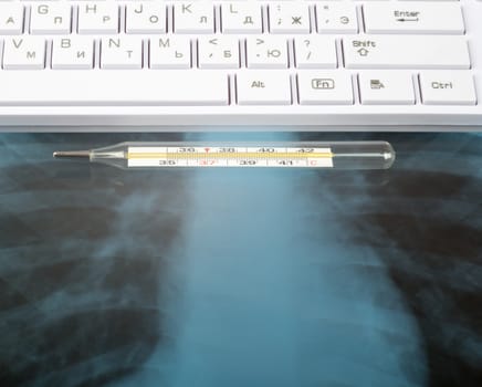 X-ray examination and white keyboard with thermometer, pen