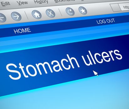 Illustration depicting a computer screen capture with a stomach ulcer concept.