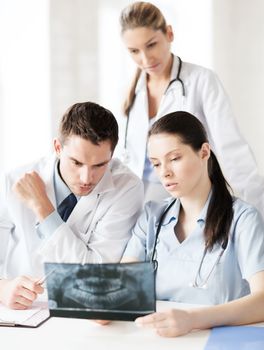 healthcare, medical and radiology concept - group of doctors looking at x-ray