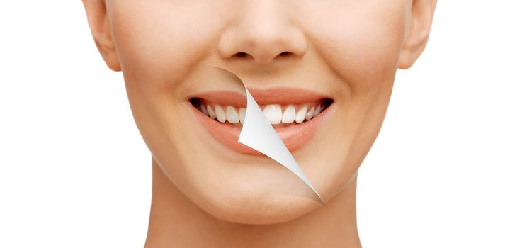 beauty and dental health concept - beautiful woman with white teeth, before and after