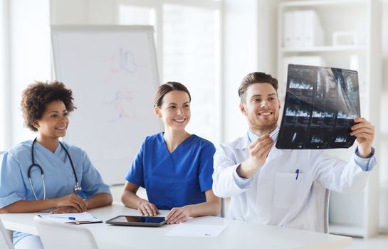 radiology, people and medicine concept - group of happy doctors looking to and discussing x-ray image at hospital