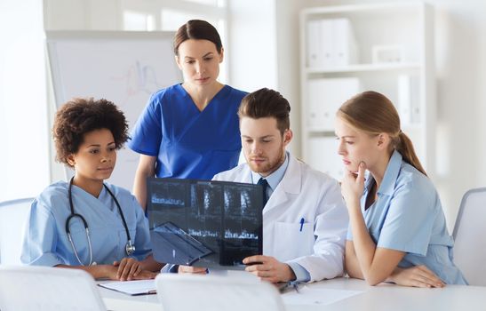 radiology, people and medicine concept - group of doctors looking to and discussing x-ray image at hospital