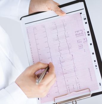 bright picture of male doctor hands with cardiogram