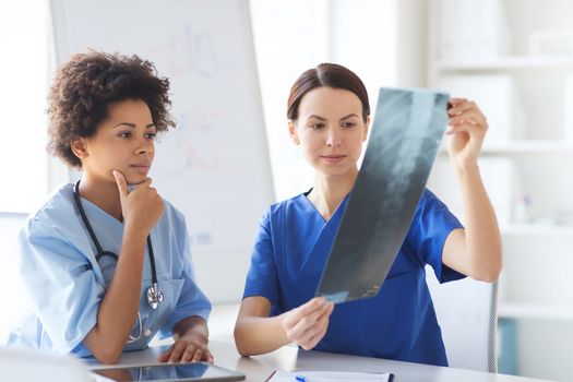 radiology, surgery, people and medicine concept - female doctors looking to and discussing x-ray image at hospital