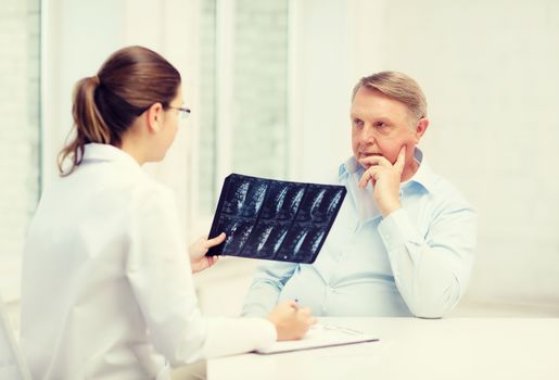 healthcare, medicine and elderly concept - female doctor with old man looking at x-ray