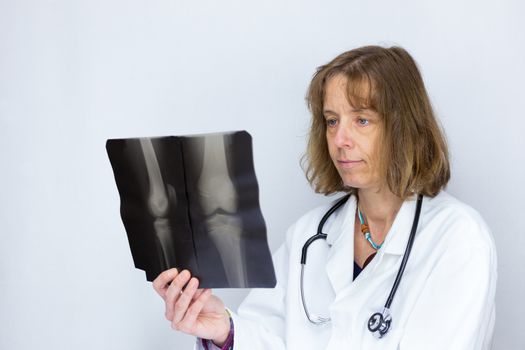 European female doctor looking at X-ray photo with knees isolated on grey white background