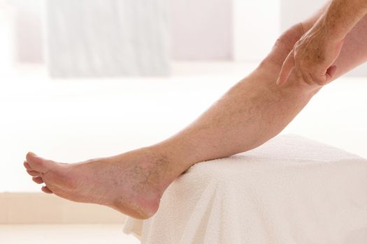 Varicose veins closeup, foot on modular bath step