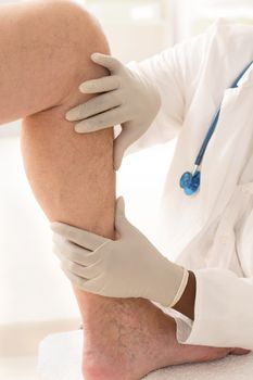 Doctor showing varicoses veins on patient's leg