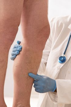 Lower limb vascular examination