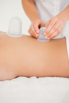 Woman with vacuum cups on her back at the health spa