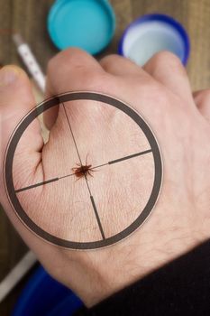 Tick-borne Encephalitis on the hand of an adult male.