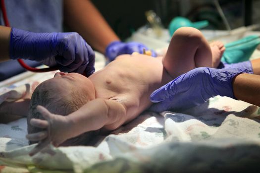 The first minutes of life of the newborn girl