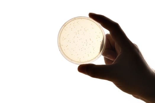 Image of a hand holding a Petri dish