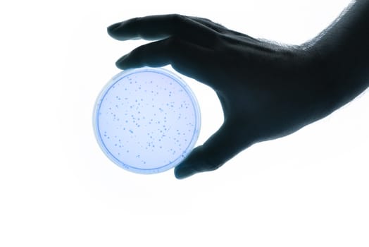 Image of a hand holding a Petri dish