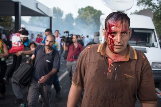 SERBIA, Horgos: Blood streams from a man's head as Hungarian riot police clash with refugees waiting to cross the border from the Serbian border town of Horgos on September 16, 2015. 