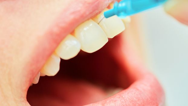 dentist brushing teeth to her patient in dental clinic