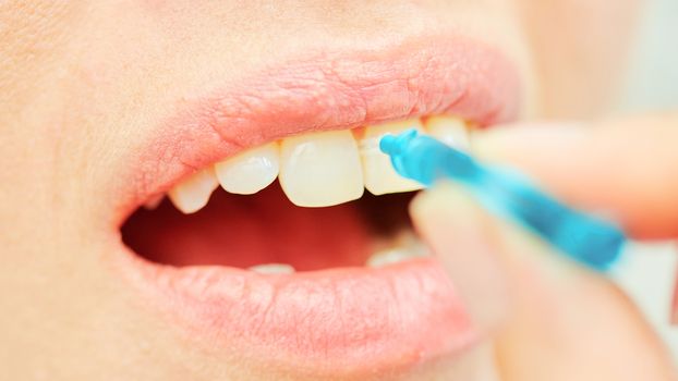 dentist brushing teeth to her patient in dental clinic