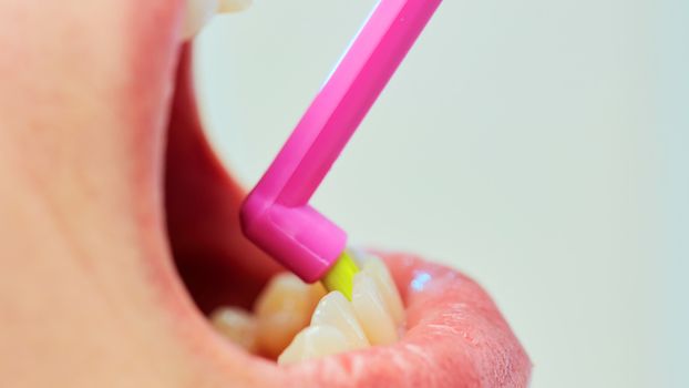 Dentist showing a woman how to brush her teeth. Closeup. Shallow dof