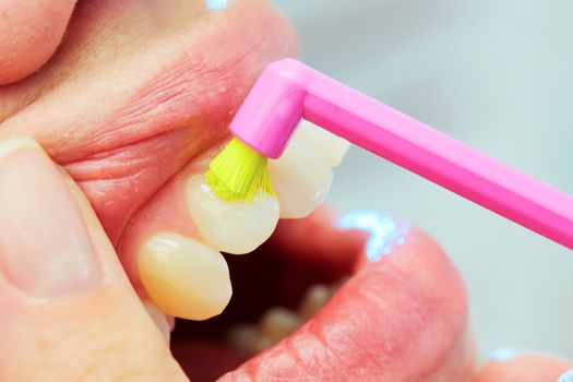 Dentist showing a woman how to brush her teeth. Closeup. Shallow dof