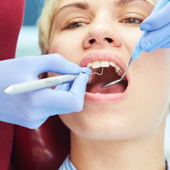 Close-up of a pretty patient with her mouth open in dental clinic