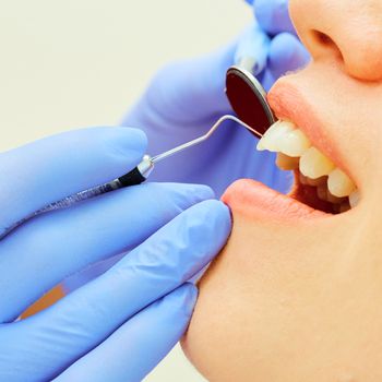 Close-up of a pretty patient with her mouth open